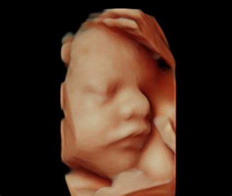 Baby scans bromsgrove